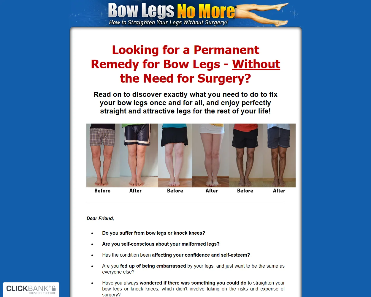 Bow Legs No More features